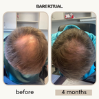 Density Boost Hair Oil 50ml | 8 Oil Blend with Rosemary, Castor & Peppermint