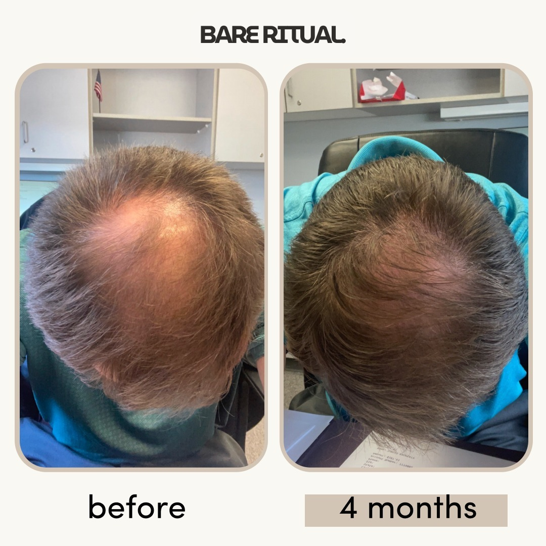 Density Boost Hair Oil 50ml | 8 Oil Blend with Rosemary, Castor & Peppermint