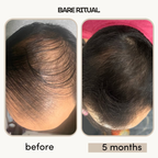 Density Boost Hair Oil 50ml | 8 Oil Blend with Rosemary, Castor & Peppermint